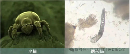防螨!已成為健康的“新剛需”--武漢時間科技推出紡織品防螨整理劑喜化®植螨零